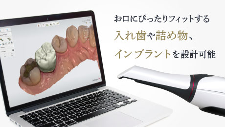 お口にぴったりフィットする入れ歯や詰め物、インプラントを設計可能