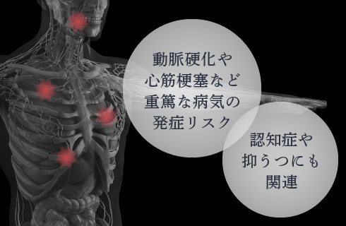 動脈硬化や心筋梗塞など重篤な病気の発症リスク・認知症や抑うつにも関連