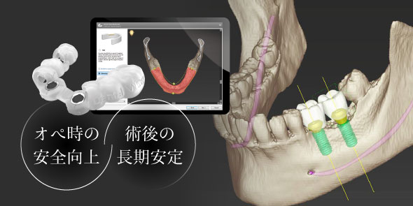 オペ時の安全向上 術後の長期安定