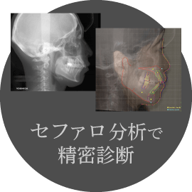 セファロ分析で精密診断